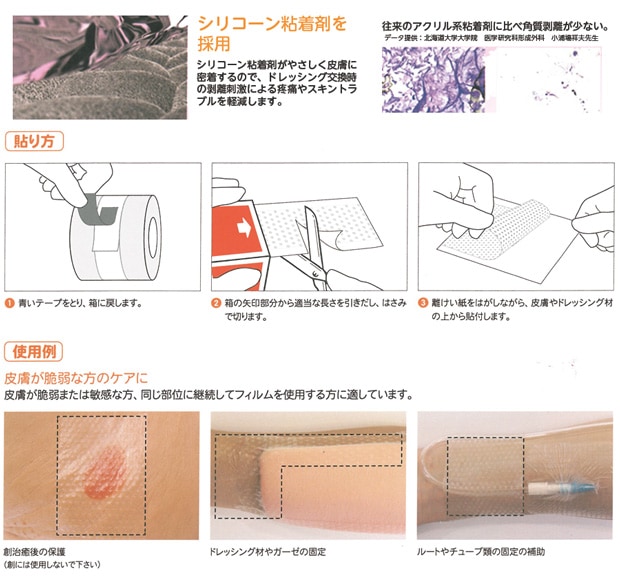 オプサイトジェントルロール 2.5cm×5m 66801195 1箱（1巻入） （取寄せ 