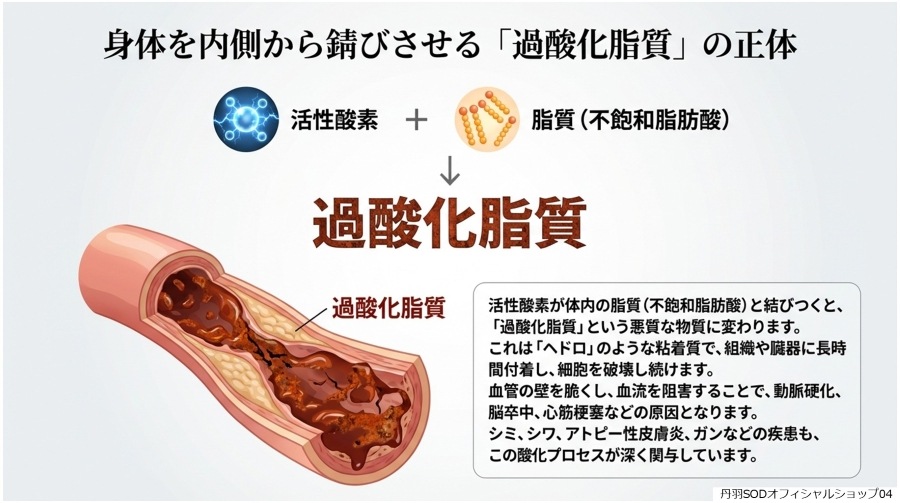 ð��SOD�Ȥϡ�ð��SOD�äƲ�04