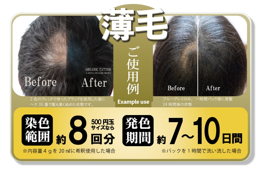 ハーブ専門店が考えた新発想の薄毛対策 オーガニックタトゥー