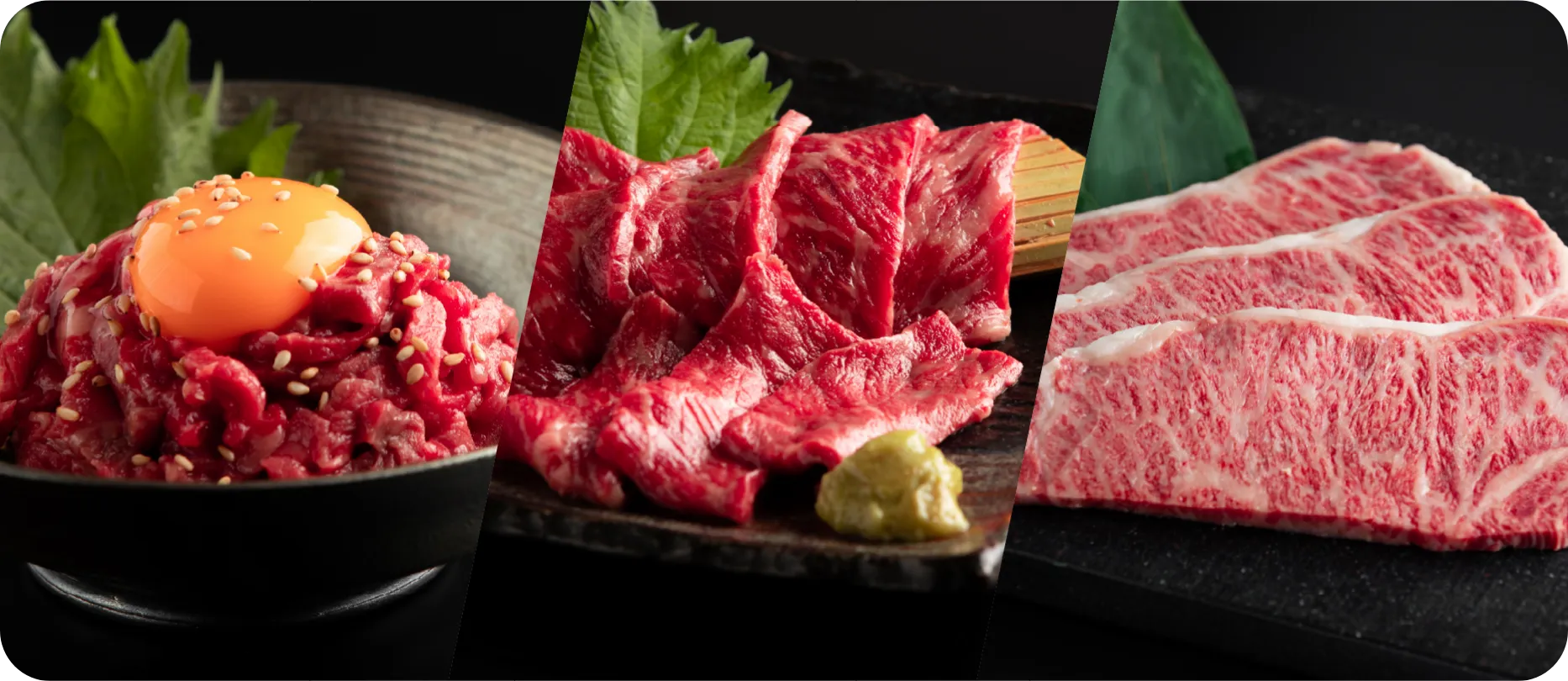 バラエティセット