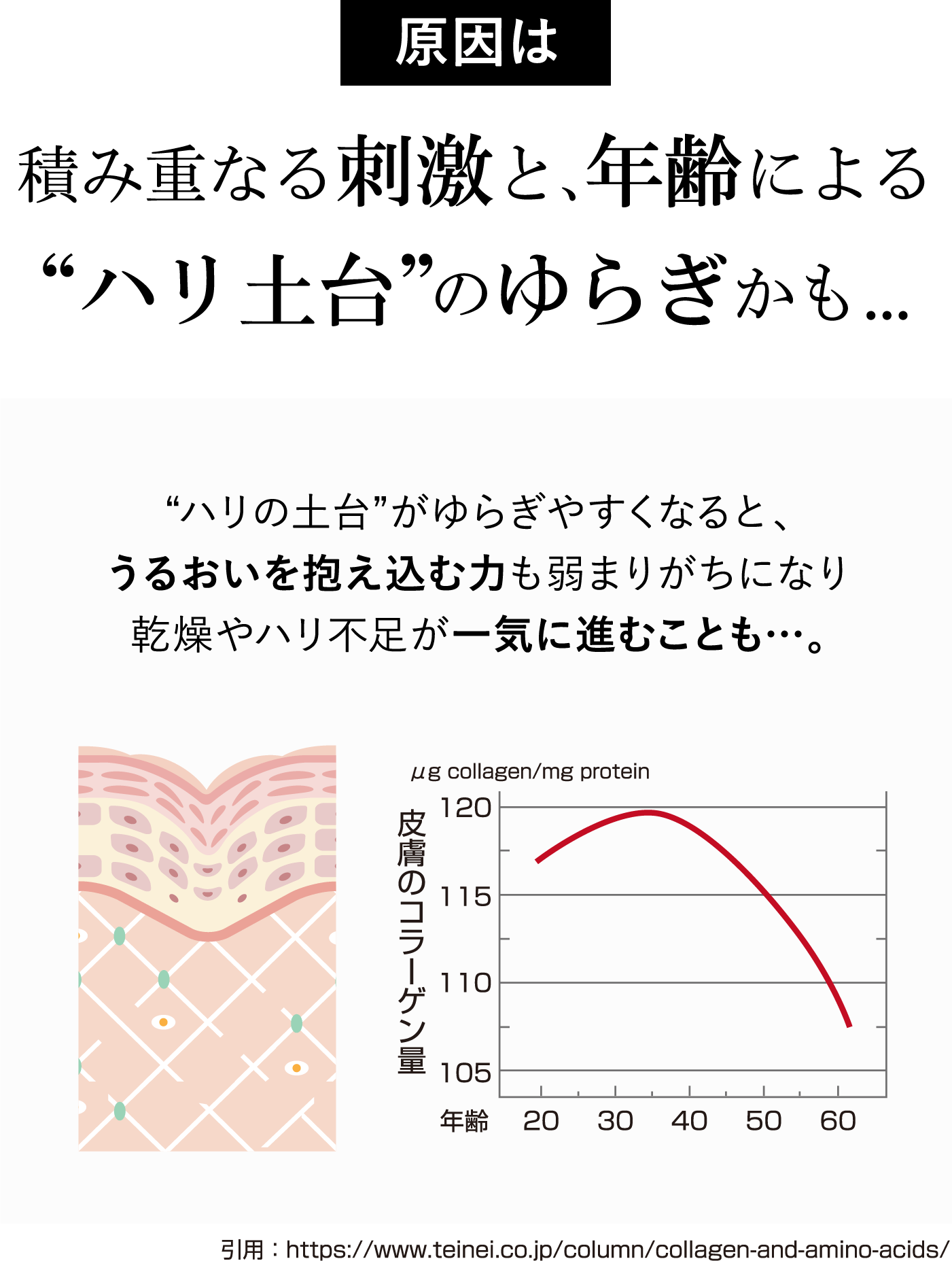 原因は積み重なる刺激と年齢によるハリ土台のゆらぎかも…
