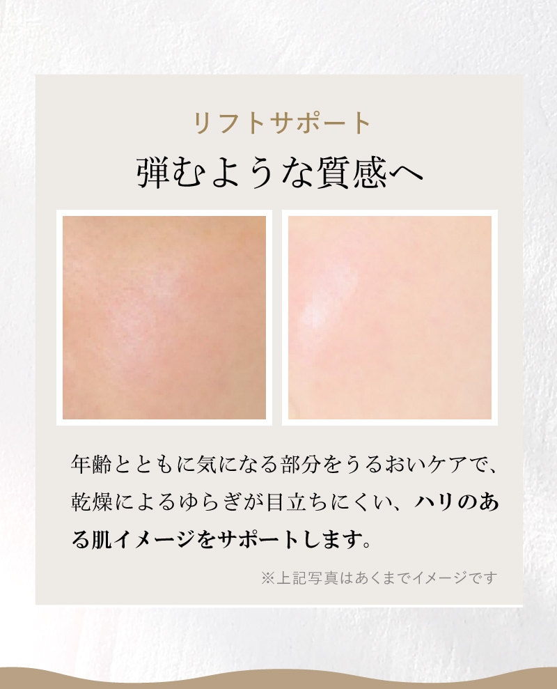 リフトサポート 弾むような質感