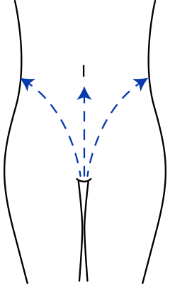 恥骨からおへそ・わき腹にむかってしたから上に