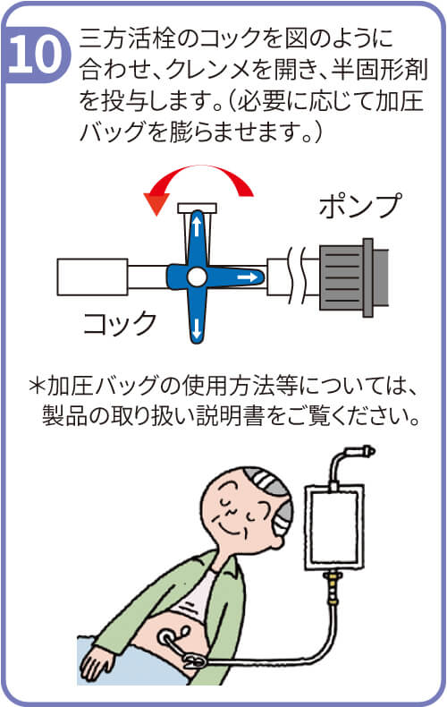 大塚製薬 半固形栄養剤用加圧バッグ 59161-0｜ 医療用品通販【ハートプラス】