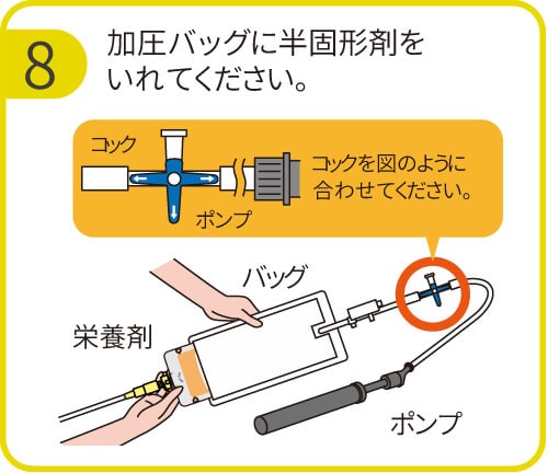 メカニカル 大塚製薬 半固形栄養剤用加圧バッグ 胃ろう - 通販