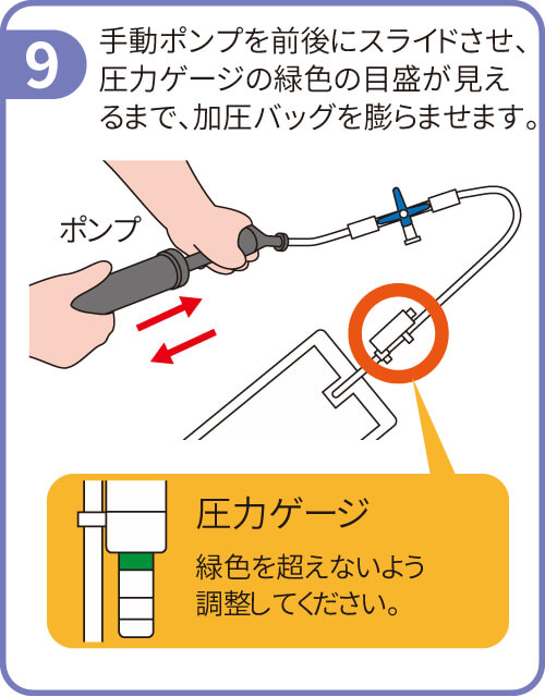 胃ろう 胃瘻 加圧バッグ しぼり器 シリンジ ラコール アダプタ - その他