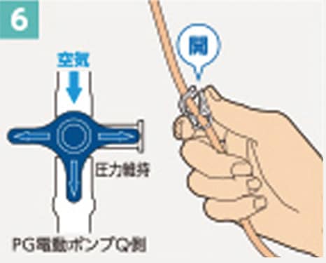 手順6：三方活栓を圧力維持側に回しPG電動ポンプQの電源を切り、連結チューブのクレンメを開けて投与を開始する