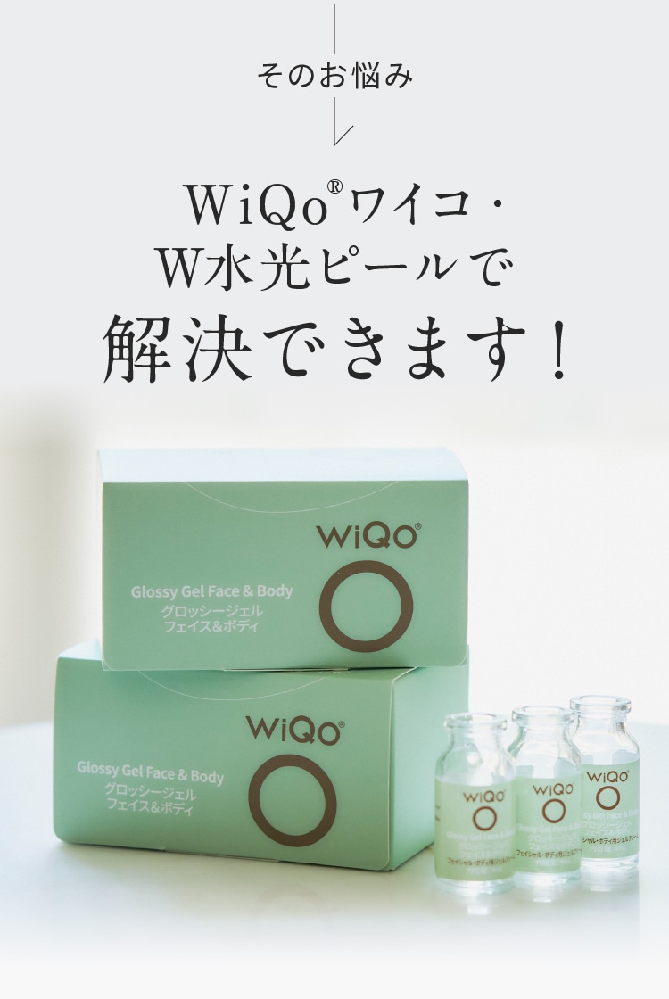 ΤǺ WiQo®磻WԡǲǤޤ