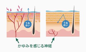 化粧 安い 水 塗っ た あと かゆい