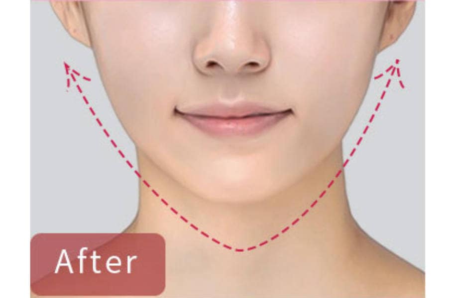 EMSリフトアップ美顔器【公式】Vフェイスフィット V-FaceFit｜目元