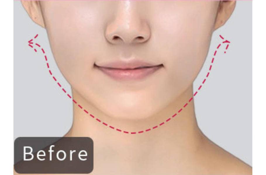 EMSリフトアップ美顔器【公式】Vフェイスフィット V-FaceFit｜目元
