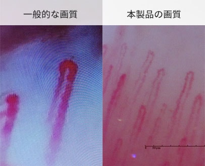 肌/頭皮/血流観察用マイクロスコープ