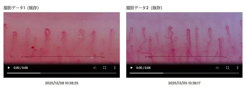 動画と写真で比較できる