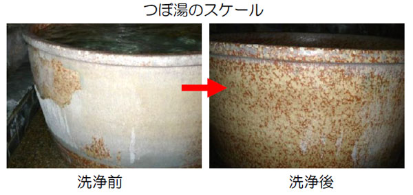 スケルトン