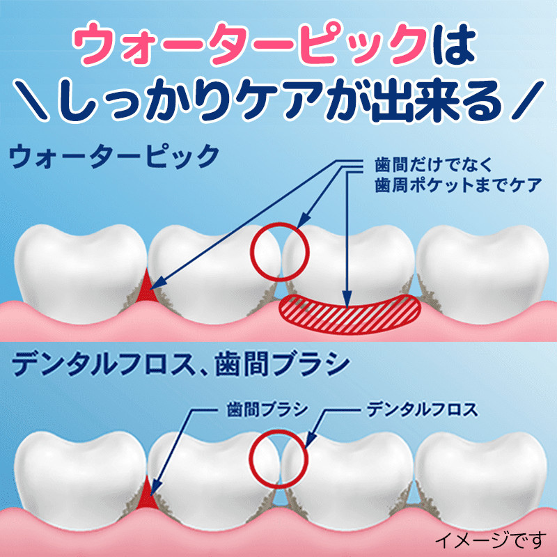 ウォーターピックはしっかりケアが出来る