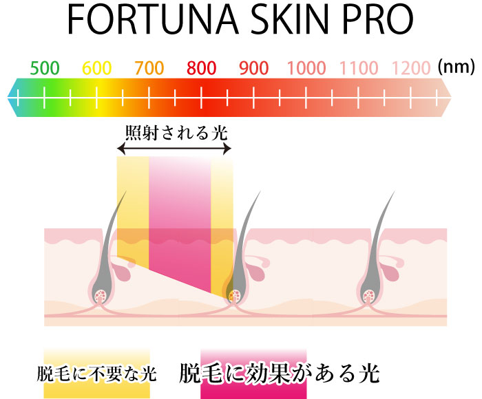 FORTUNA SKIN PROĹ