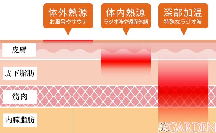 「深部加温」とは？