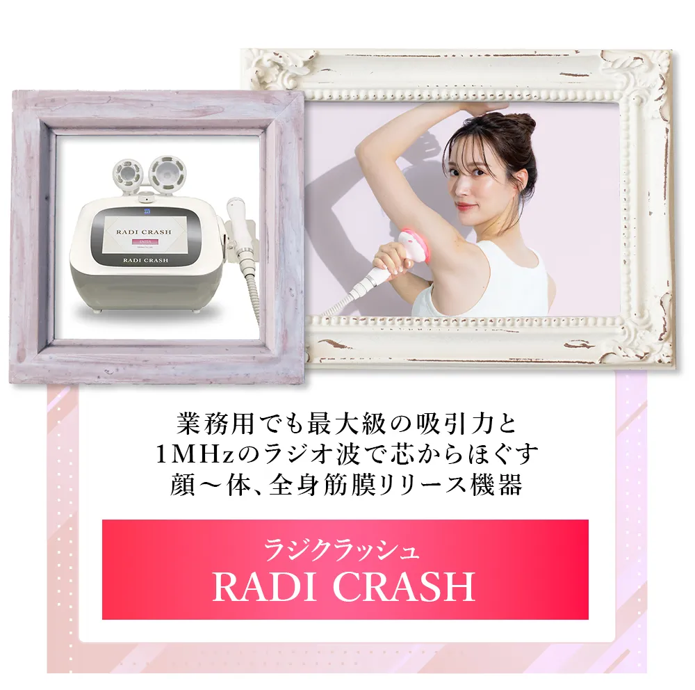 RADI CRASH