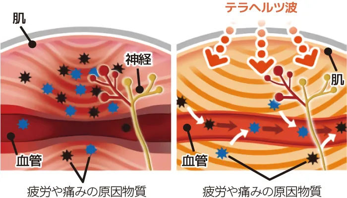 テラヘルツ波とは