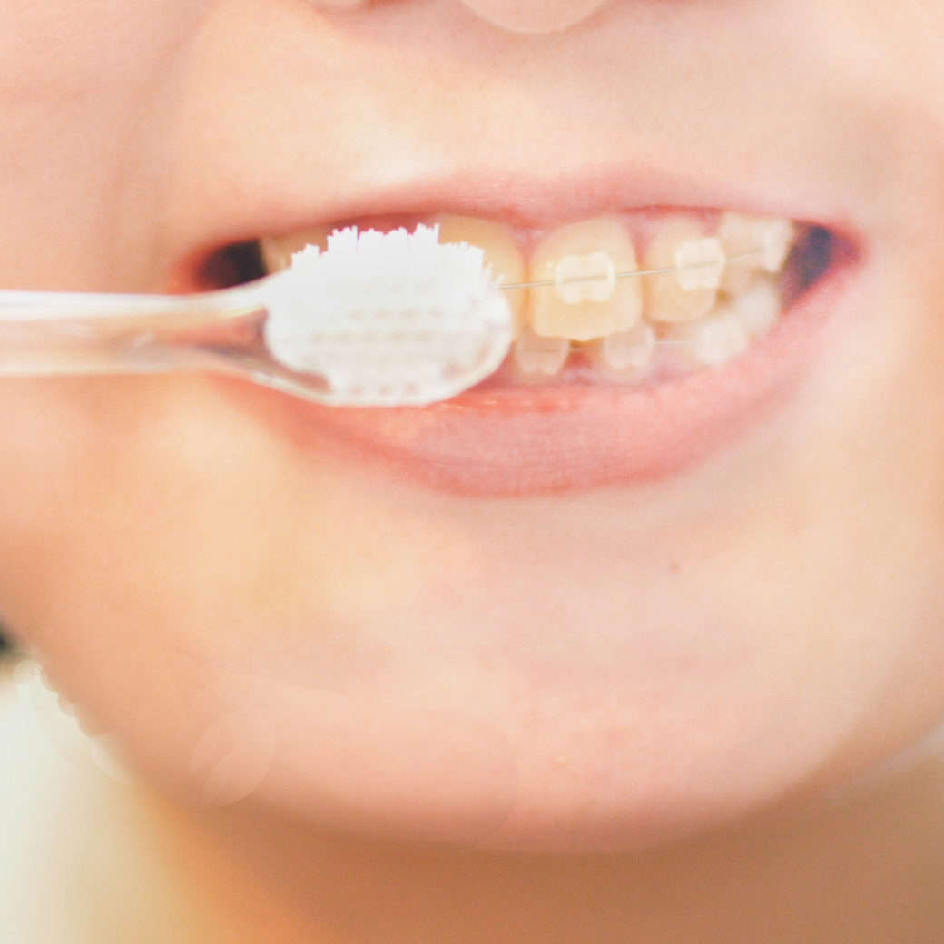 矯正用歯ブラシ