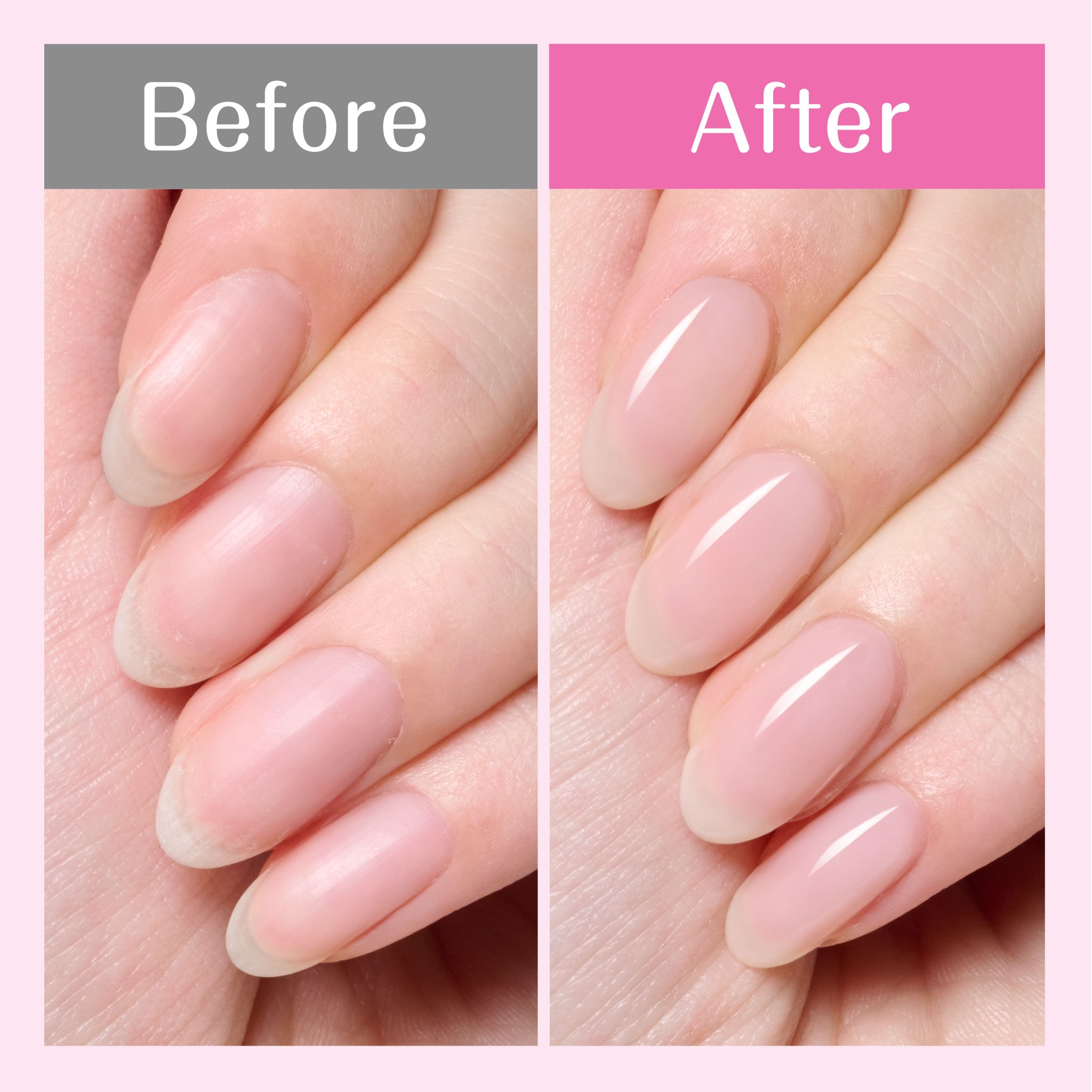 自爪を美しく魅せる ファンデーション効果 Before After