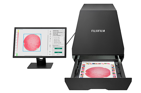 FUJIFILM Pressure Analysis Cloud