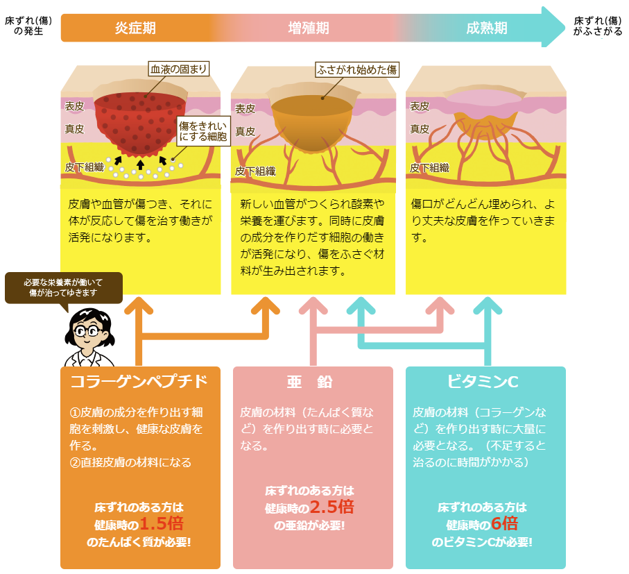 皮膚や血管が傷つき、それに体が反応して傷を治す働きが活発になります。新しい血管がつくられ酸素や栄養を運びます。同時に皮膚の成分を作りだす細胞の働きが活発になり、傷をふさぐ材料が生み出されます。傷口がどんどん埋められ、より丈夫な皮膚を作っていきます。コラーゲンペプチド①皮膚の成分を作り出す細胞を刺激し、健康な皮膚を作る。②直接皮膚の材料になる床ずれのある方は健康時の1.5倍のたんぱく質が必要! 亜　鉛皮膚の材料（たんぱく質など）を作り出す時に必要となる。床ずれのある方は健康時の2.5倍の亜鉛が必要!ビタミンC皮膚の材料（コラーゲンなど）を作り出す時に大量に必要となる。（不足すると治るのに時間がかかる）床ずれのある方は健康時の6倍のビタミンCが必要!