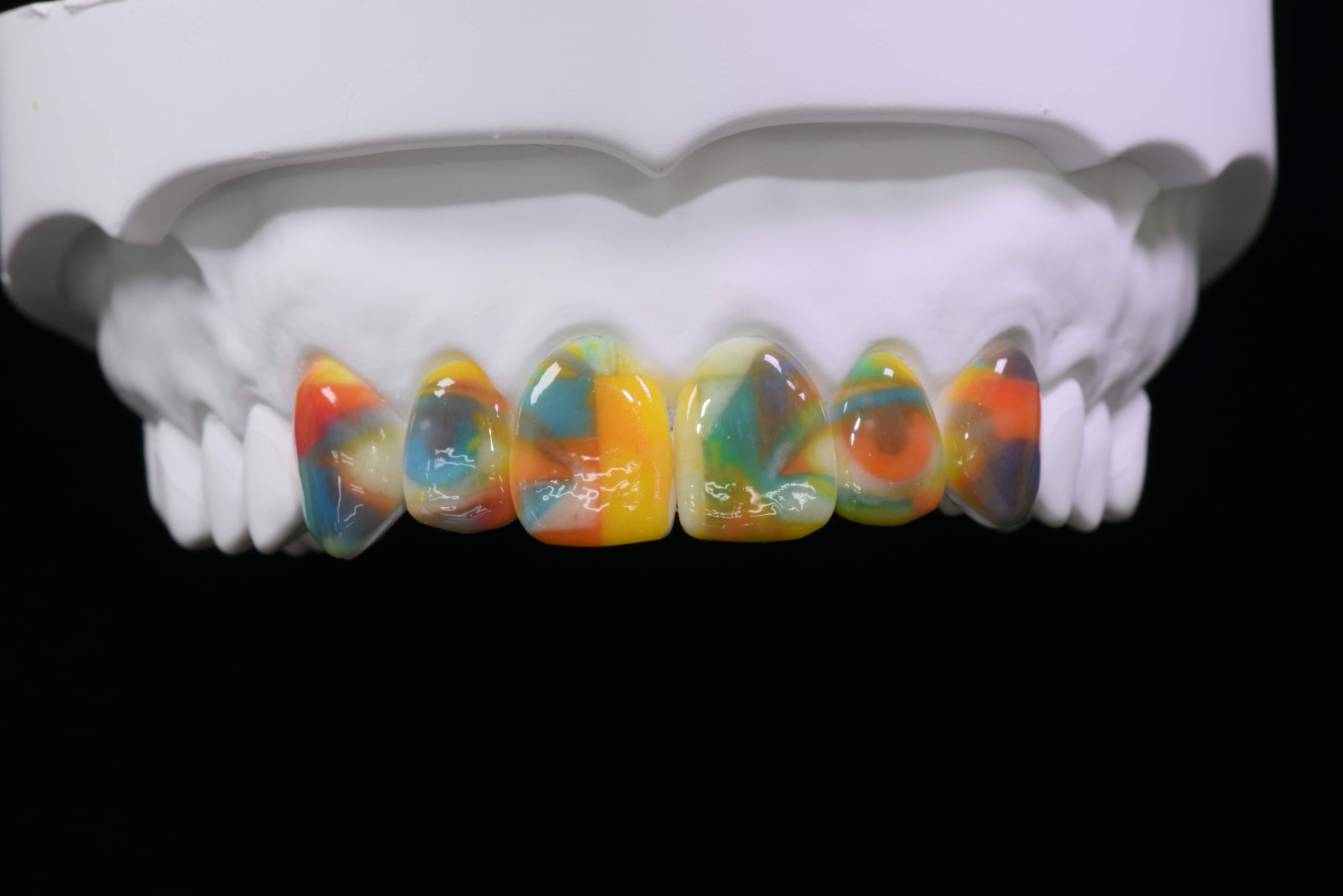 付け歯で魅せるハロウィンコーデ！SNS映えするスタイル集