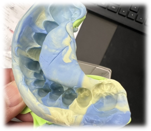 パテの混ぜ不足（硬化不良）