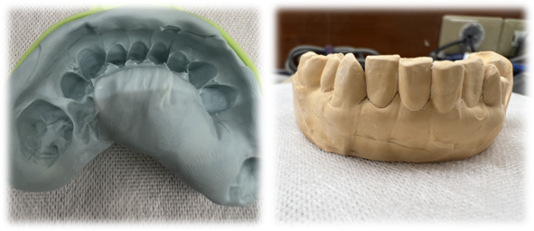 良い例（境目くっきり・厚め）