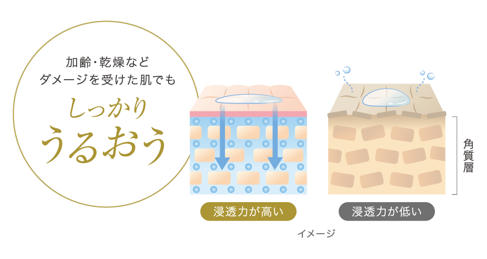 角質