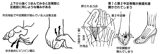 第1指と第2指の間の痛み カサハラ式公式サイト カサハラフットケアショップ カサハラ式公式サイト カサハラフットケアショップ