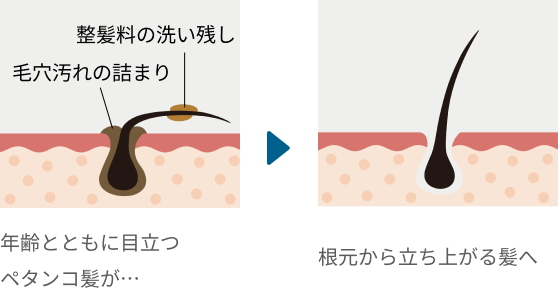 年齢とともに目立つペタンコ髪が…根元から立ち上がる髪へ