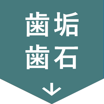 歯垢・歯石が気になる犬用：お口