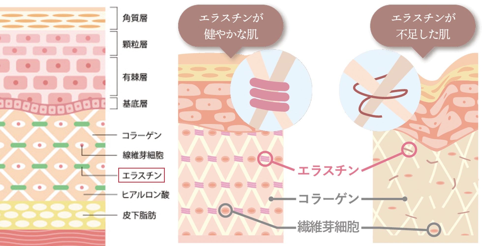 エラスチン