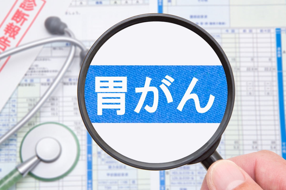 胃がんを予防するには？原因や生活習慣について解説