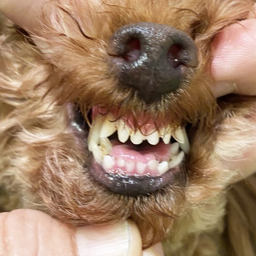 ���β���