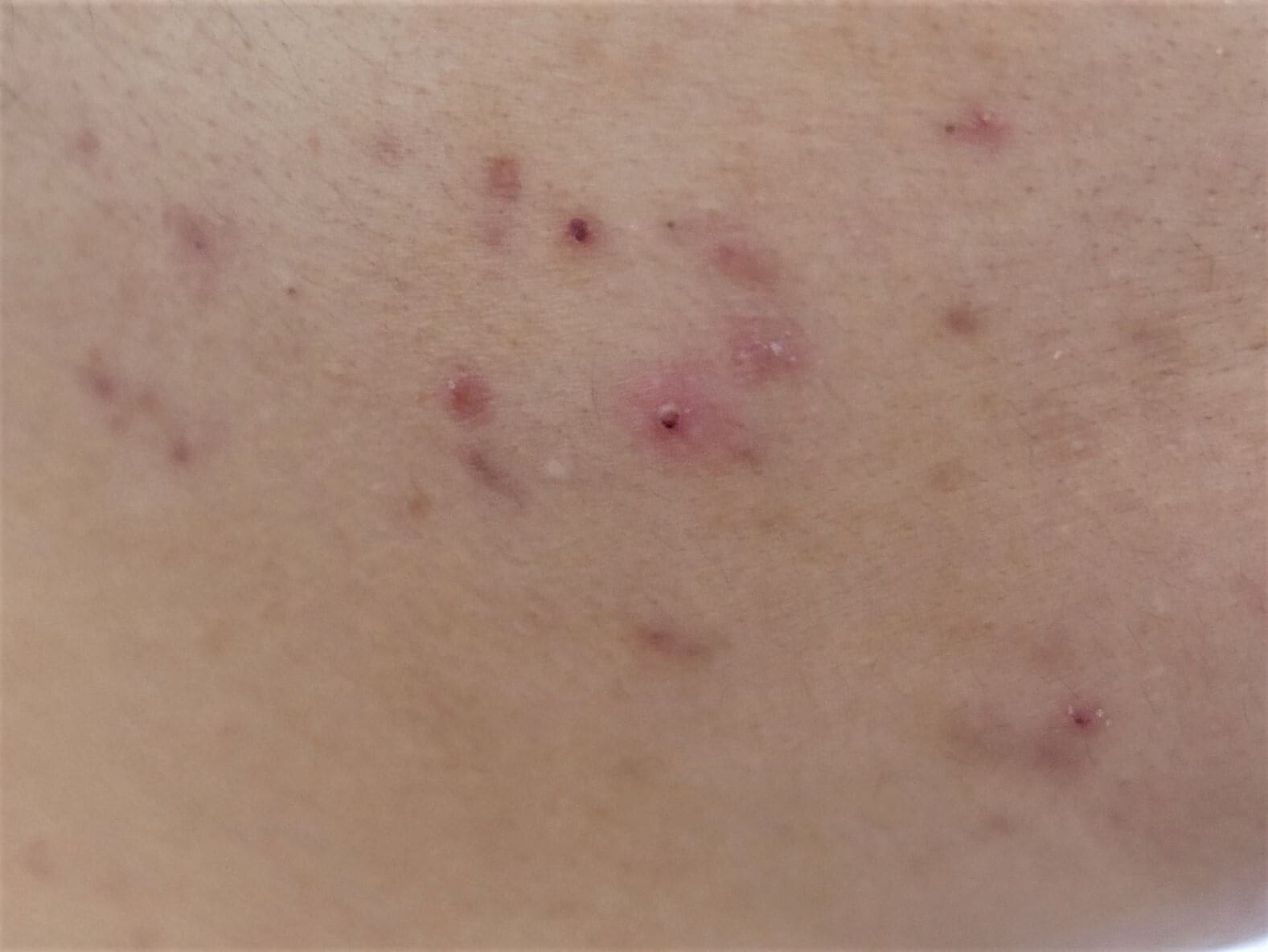 ���ǤˤǤ��Ƥ��ޤä��˥����פ��н�ˡ�������̥�����NG��ư�θ�ľ��