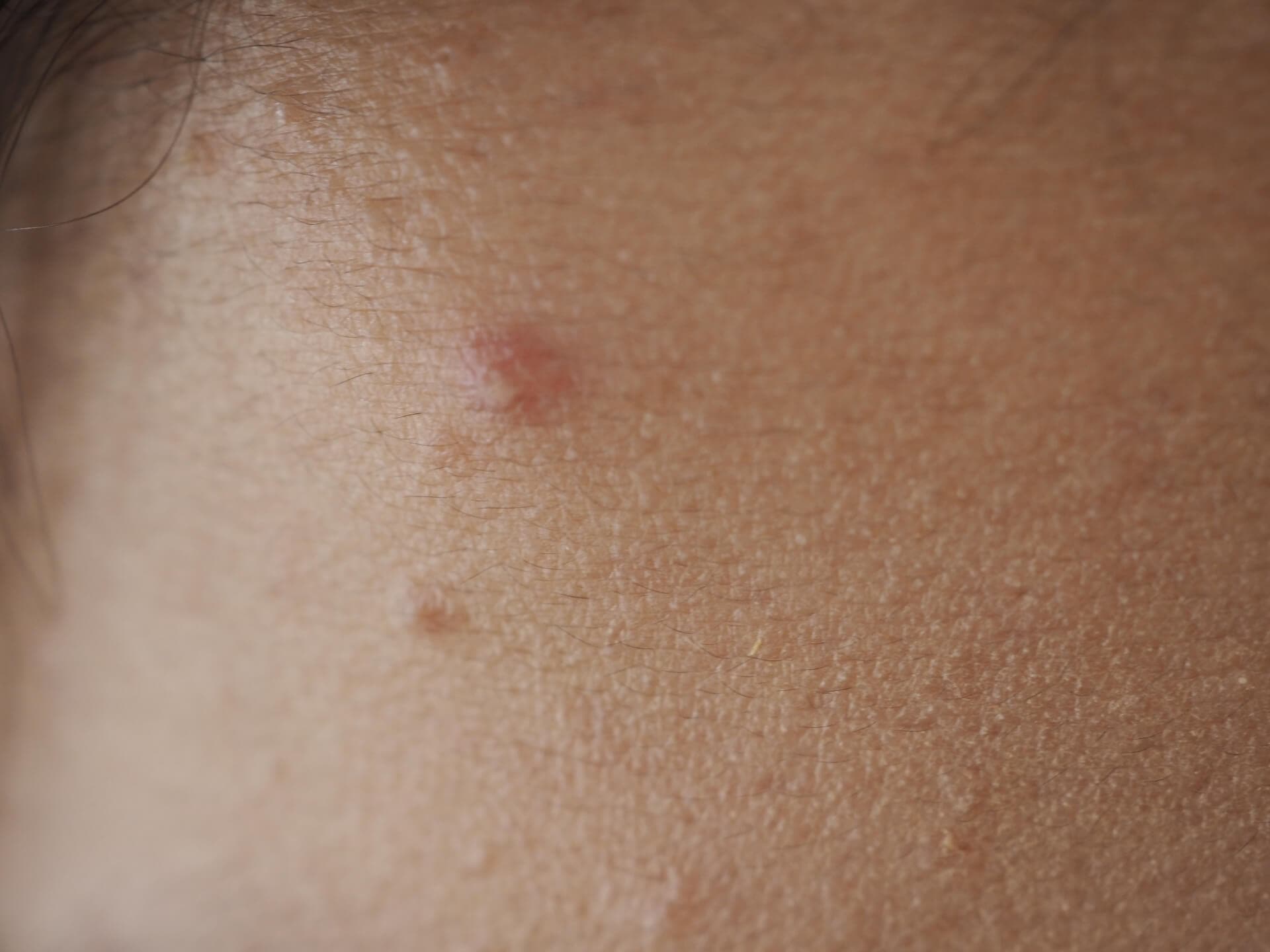 ��ͥ˥��Ӥ䥷�ߤ�ȯ������ᥫ�˥���