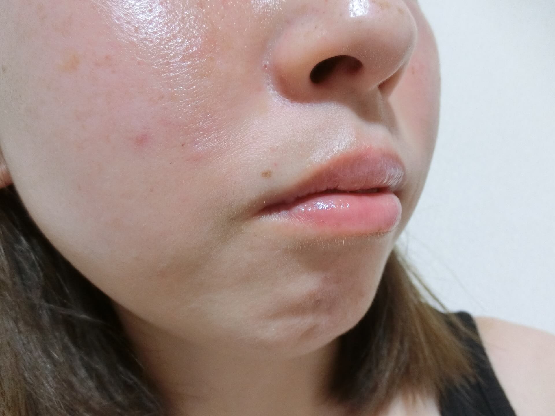 �˥����פμ������ħ