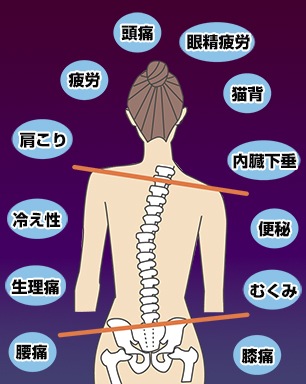 骨盤が歪むと起こる体の不調