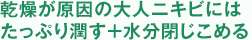 乾燥が原因の大人ニキビにはたっぷり潤す十分閉じ込める