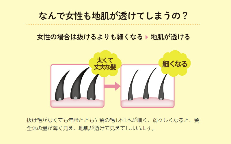 さよなら、カチコチ地肌