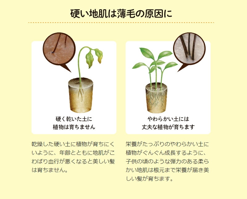 さよなら、カチコチ地肌