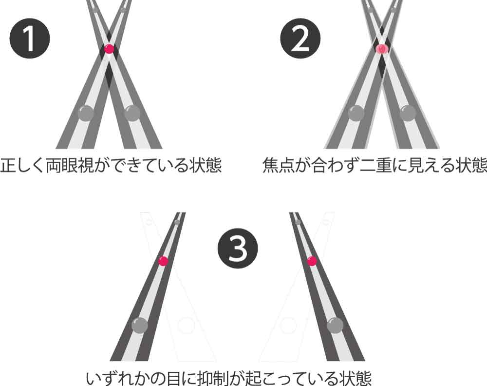 両眼視トレーニングマシン