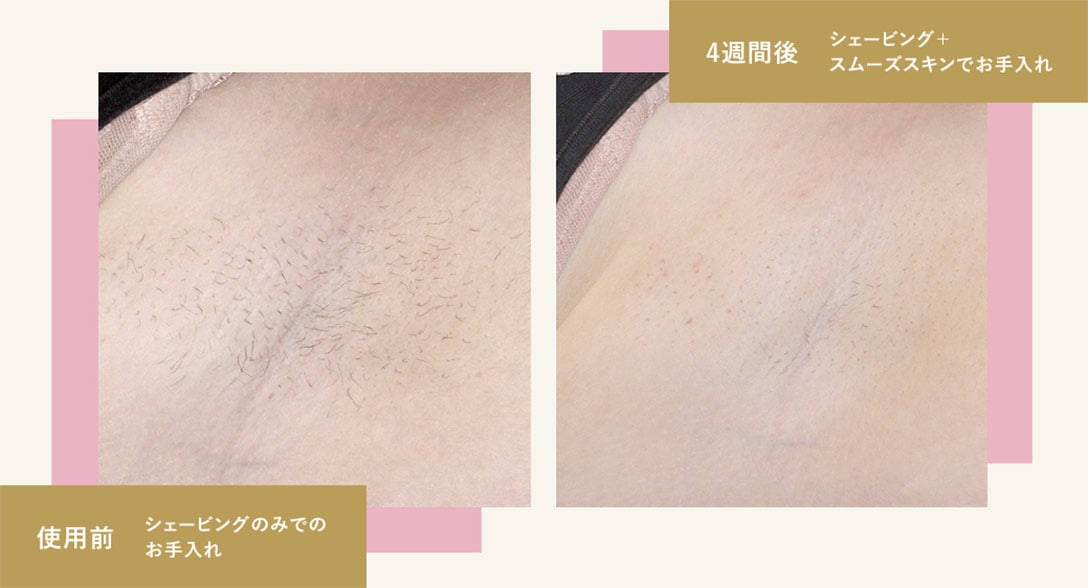 脱毛器 スムーズスキン ベアプラス SMOOTHSKIN www.krzysztofbialy.com