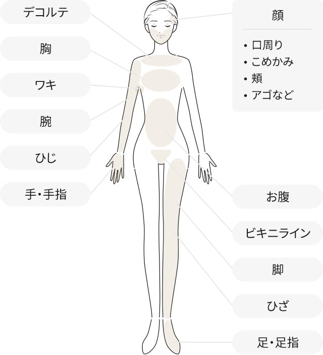 デコルテ/胸/ワキ/腕/ひじ/手・手指/顔|口周り|こめかみ|頬|アゴなど/お腹/ビキニライン/脚/ひざ/足・足指/