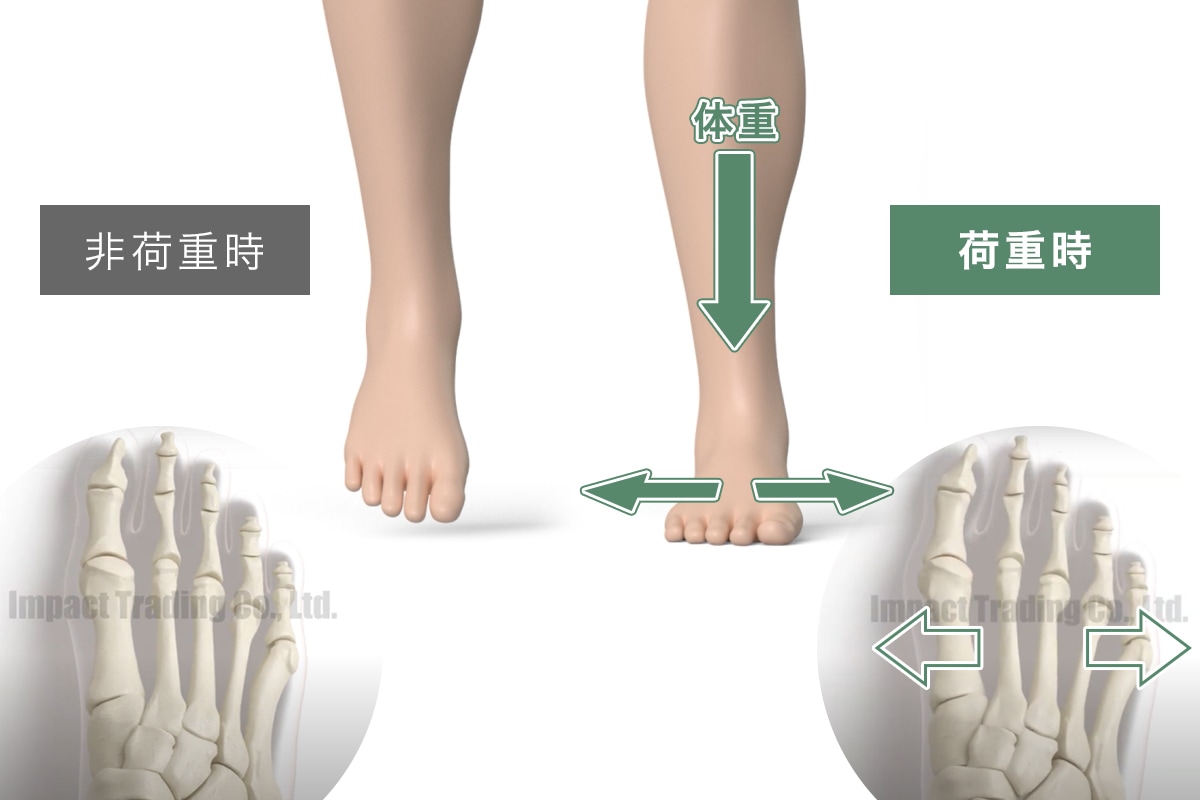 Life Otc 医療品由来の高機能インソール 外反母趾など 親指の付け根の痛みでお悩みの方へ Nwpl公式オンラインストア