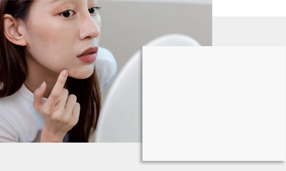 アゼライン酸のその他の用途