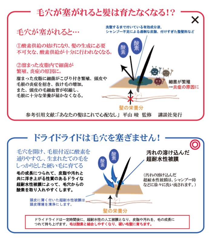 まるで瞬間発毛剤のような育毛剤！？発毛促進＆育毛剤ドライドライド QZ-3D 120ml 【育毛スプレー】【医薬部外品】 | 育毛・発毛促進,育毛・ 発毛促進剤 | リアンドゥ・モール